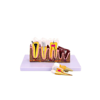 6x Comprehensive Pathological Dental Model image 0
