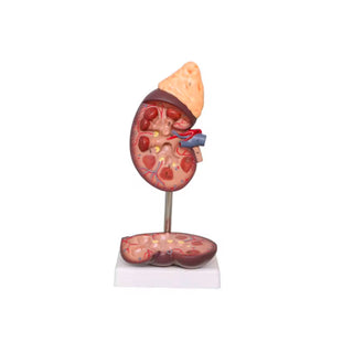 Human Kidney With The Gland Model image 0