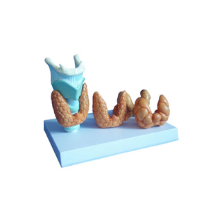 Thyroid Lesion Model image 0