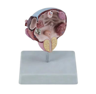 Bladder & Prostate Disease Model