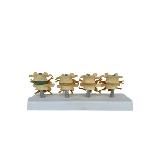 Lumbar Osteoporosis & Disc Herniation Model
